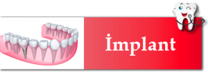 implant1-300x106